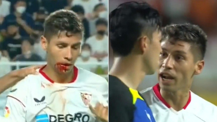 Gonzalo Montiel, herida y bronca con el futbolista del Tottenham.