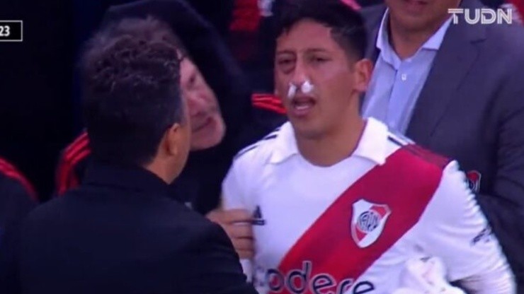 La imagen de Rodrigo Aliendro luego del golpe en su rostro.